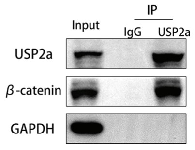 Co-IP assays of the interaction between USP2a and β-catenin in HTR8.jpg
